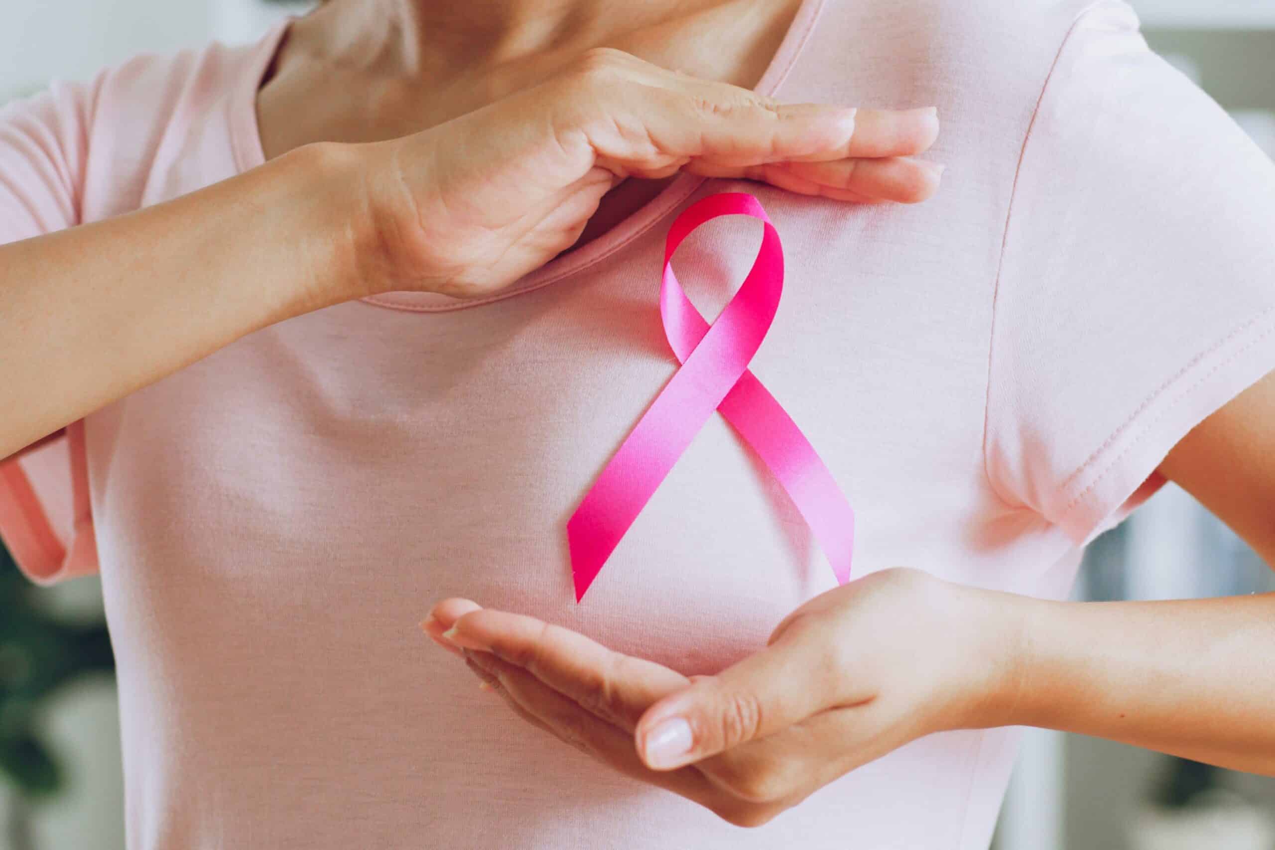 Peut-on garder son sein après un cancer du sein ? | Institut du Sein | Paris